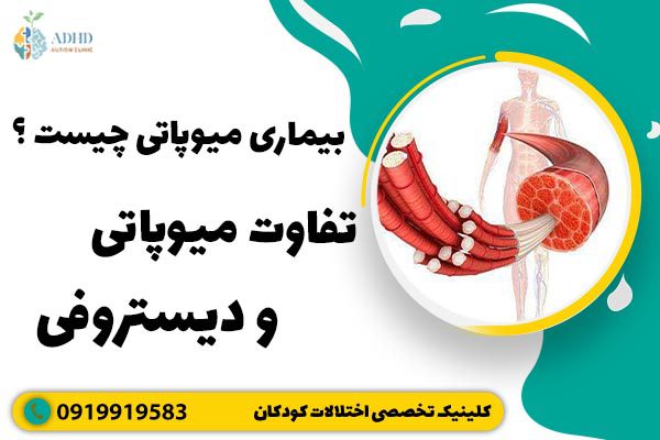 بیماری میوپاتی چیست ؟ تفاوت میوپاتی و دیستروفی